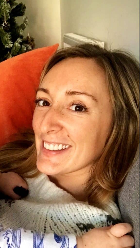 Smile Makeover - Veneers - Leah - Aloe Vera Dental Studio - Essex