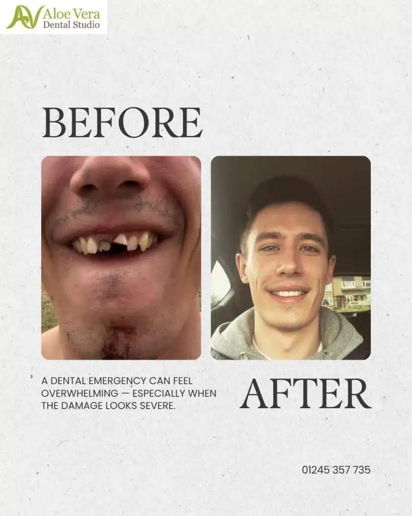 emergency dentist Chelmsford