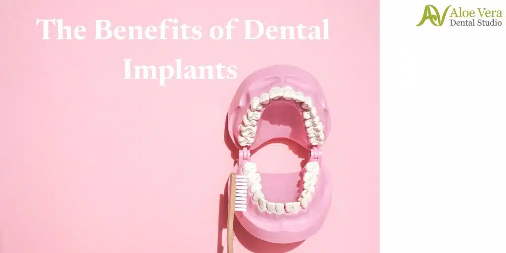 dental implants