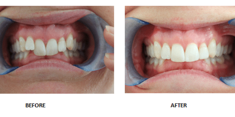 Before-and-after-1