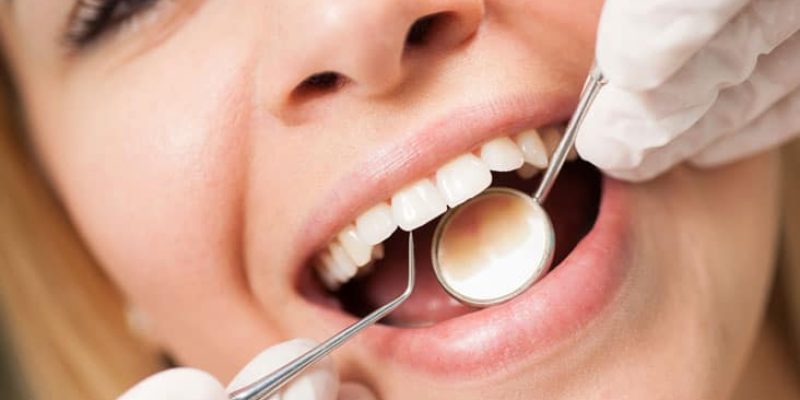dental-oral-health-what-happens-during-a-tooth-cleaning_thumb